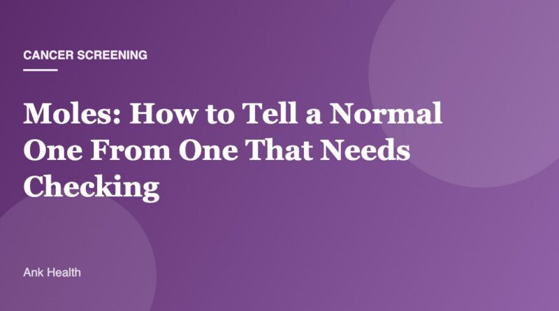 Moles: How to Tell a Normal One From One That Needs Checking
